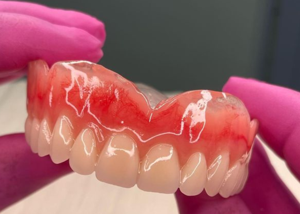 Prótese Dentária Removível Tipos Modelos E Indicações Paraíso Odonto 5561